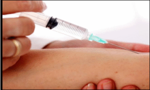 Cy-TB Skin Test | UPSC Compass