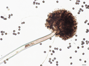 Aspergillus Section Nigri | UPSC Compass